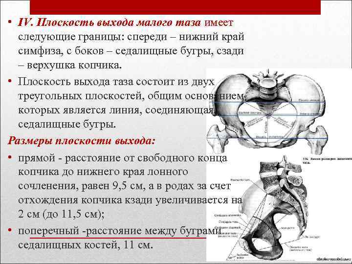  • IV. Плоскость выхода малого таза имеет следующие границы: спереди – нижний край