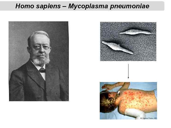 Homo sapiens – Mycoplasma pneumoniae 