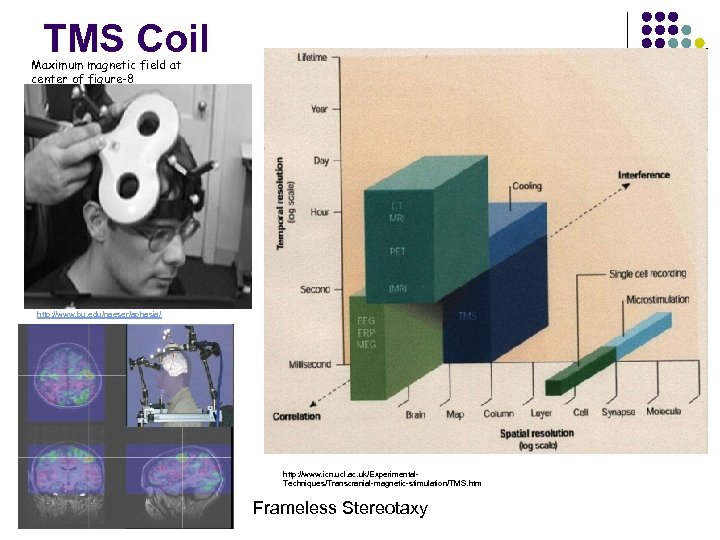 TMS Coil Maximum magnetic field at center of figure-8 http: //www. bu. edu/naeser/aphasia/ http: