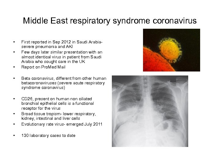 Middle East respiratory syndrome coronavirus • • • First reported in Sep 2012 in