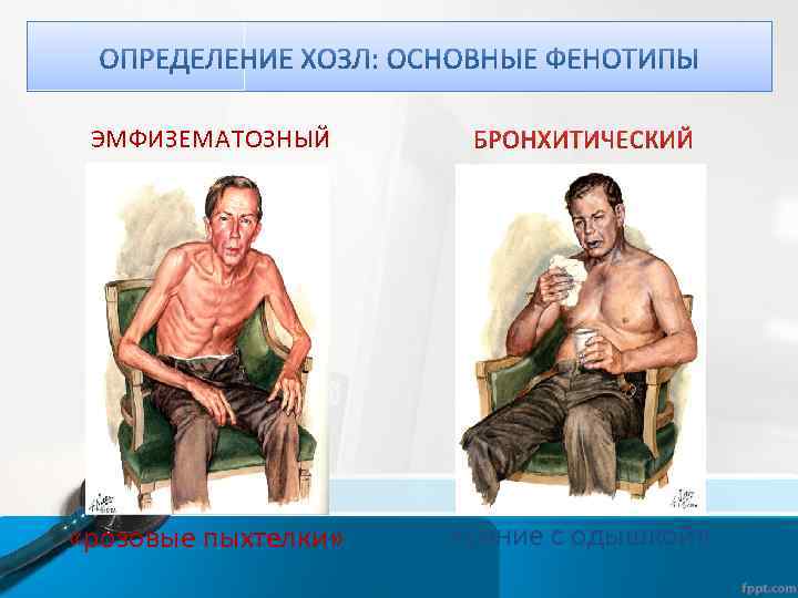 ЭМФИЗЕМАТОЗНЫЙ «розовые пыхтелки» «синие с одышкой» 