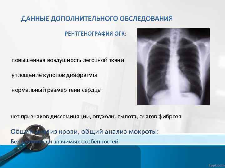 повышенная воздушность легочной ткани уплощение куполов диафрагмы нормальный размер тени сердца нет признаков диссеминации,