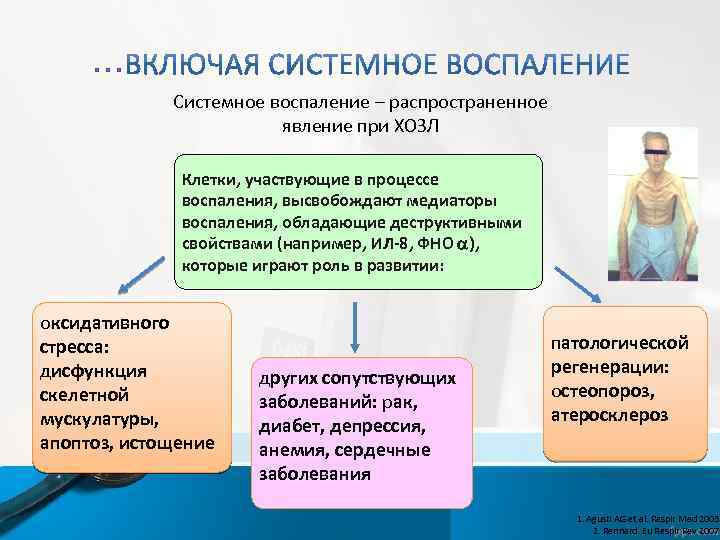 … Системное воспаление – распространенное явление при ХОЗЛ Клетки, участвующие в процессе воспаления, высвобождают