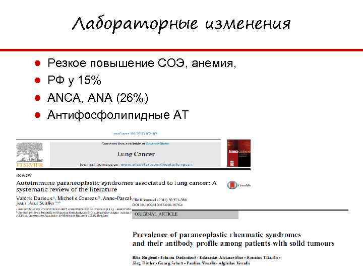 Лабораторные изменения ● ● Резкое повышение СОЭ, анемия, РФ у 15% ANCA, ANA (26%)