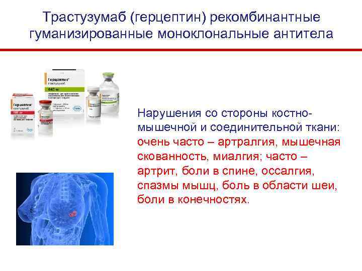 Трастузумаб (герцептин) рекомбинантные гуманизированные моноклональные антитела Нарушения со стороны костномышечной и соединительной ткани: очень