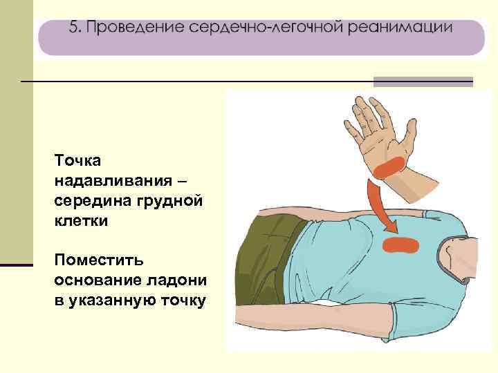 Точка надавливания – середина грудной клетки Поместить основание ладони в указанную точку 