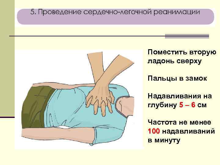 Поместить вторую ладонь сверху Пальцы в замок Надавливания на глубину 5 – 6 см
