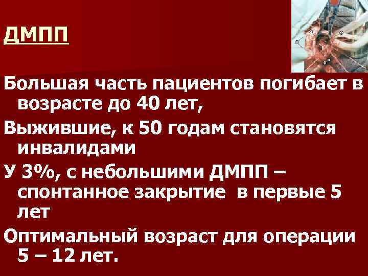 ДМПП Большая часть пациентов погибает в возрасте до 40 лет, Выжившие, к 50 годам