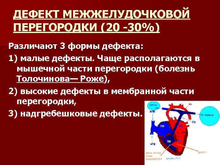 ДЕФЕКТ МЕЖЖЕЛУДОЧКОВОЙ ПЕРЕГОРОДКИ (20 30%) Различают 3 формы дефекта: 1) малые дефекты. Чаще располагаются