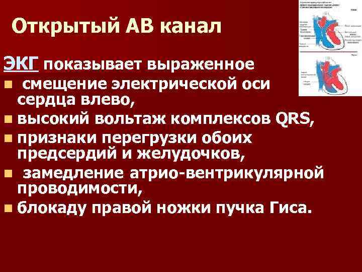 Признаки перегрузки сердца. Перегрузка обоих предсердий. Электрическая ось сердца презентация. Открытий Атрио- вентрикулярный. Открытый АВ_канал патофизиология.