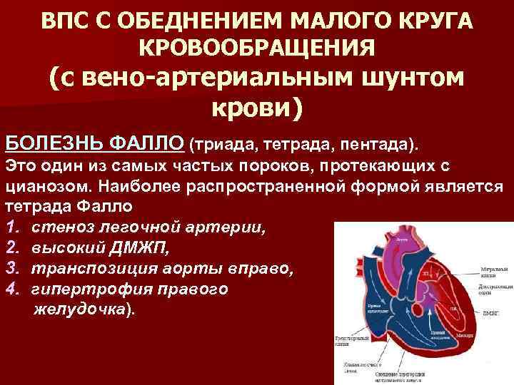 Порок сердца у ребенка. Этиология врожденных пороков сердца. Причины развития у детей врожденного порока сердца. Основные клинические симптомы врождённых пороков сердца. Врожденный порок сердца с обеднением малого круга кровообращения.