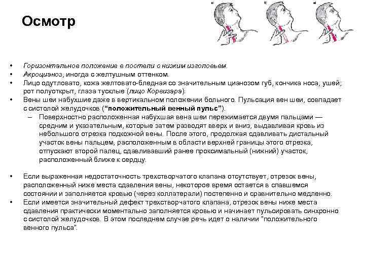 Осмотр • • • Горизонтальное положение в постели с низким изголовьем. Акроцианоз, иногда с