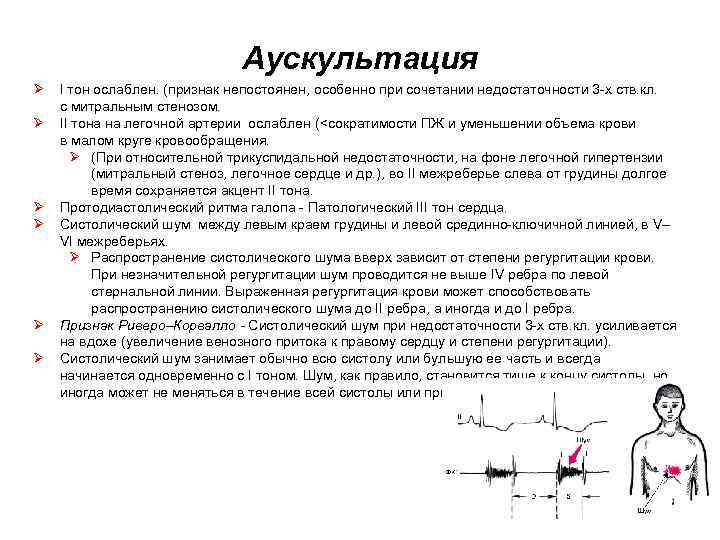 Аускультация Ø Ø Ø I тон ослаблен. (признак непостоянен, особенно при сочетании недостаточности 3