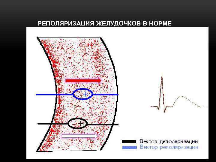 РЕПОЛЯРИЗАЦИЯ ЖЕЛУДОЧКОВ В НОРМЕ 
