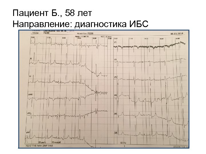 Пациент Б. , 58 лет Направление: диагностика ИБС 