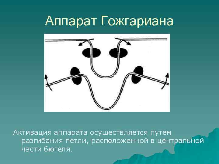 Ортодонтические аппараты механического действия презентация