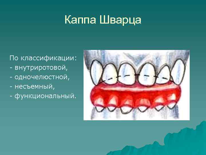 Доклад по теме Каппа Бынина