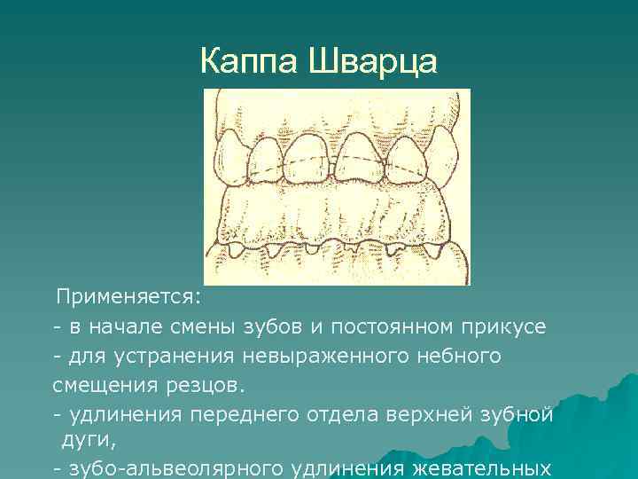 Ортодонтические аппараты механического действия презентация