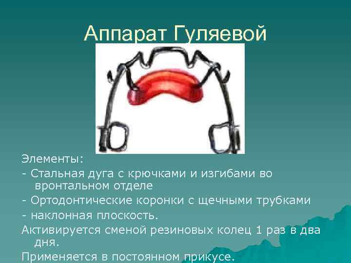 Презентация ортодонтические дуги