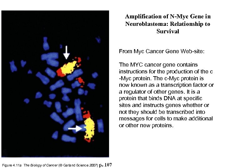 Amplification of N-Myc Gene in Neuroblastoma: Relationship to Survival From Myc Cancer Gene Web-site: