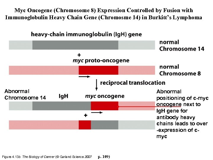 Myc Oncogene (Chromosome 8) Expression Controlled by Fusion with Immunoglobulin Heavy Chain Gene (Chromosme