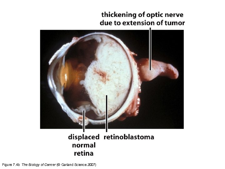 Figure 7. 4 b The Biology of Cancer (© Garland Science 2007) 