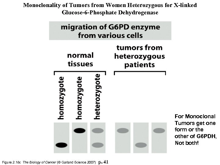 Monoclonality of Tumors from Women Heterozygous for X-linked Glucose-6 -Phosphate Dehydrogenase For Monoclonal Tumors