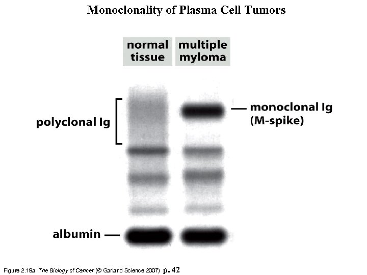 Monoclonality of Plasma Cell Tumors Figure 2. 19 a The Biology of Cancer (©