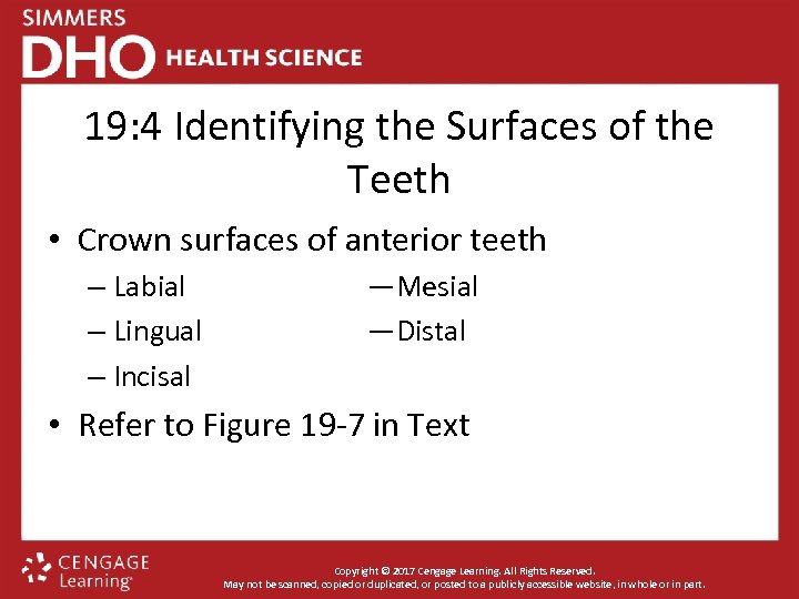 19: 4 Identifying the Surfaces of the Teeth • Crown surfaces of anterior teeth