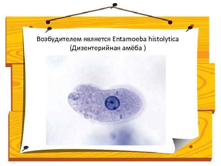 Возбудителем является Entamoeba histolytica (Дизентерийная амёба ) 