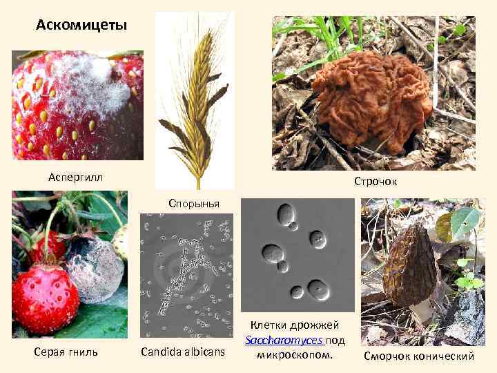 Аскомицеты Аспергилл Строчок Спорынья Серая гниль Candida albicans Клетки дрожжей Saccharomyces под микроскопом. Сморчок