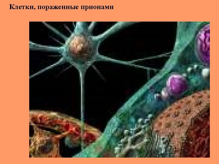 Клетки, пораженные прионами 