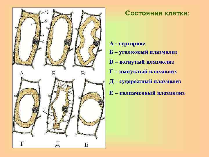 Состояния клетки: А - тургорное Б – уголковый плазмолиз В – вогнутый плазмолиз Г
