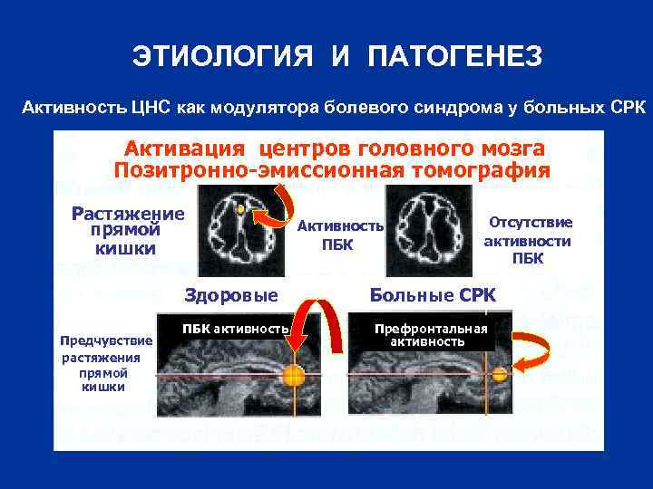 ЭТИОЛОГИЯ И ПАТОГЕНЕЗ Активность ЦНС как модулятора болевого синдрома у больных СРК Активация центров