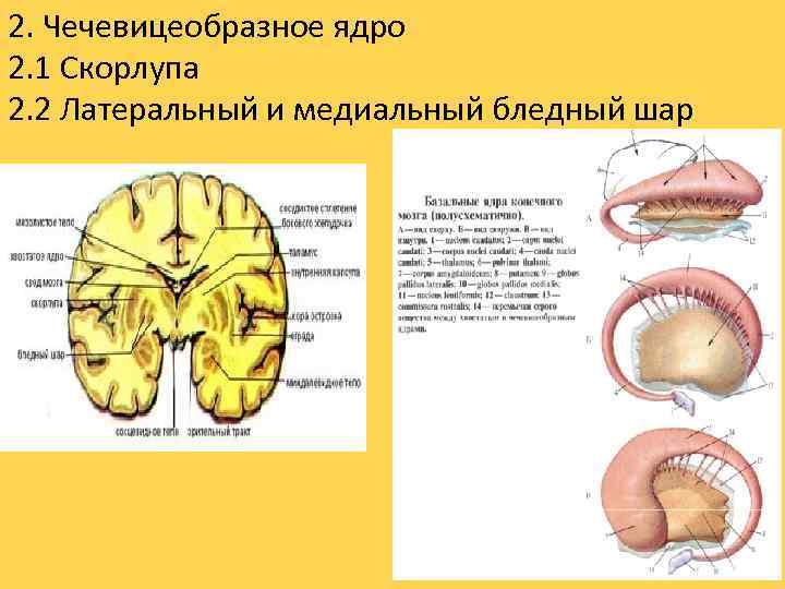 2. Чечевицеобразное ядро 2. 1 Скорлупа 2. 2 Латеральный и медиальный бледный шар 