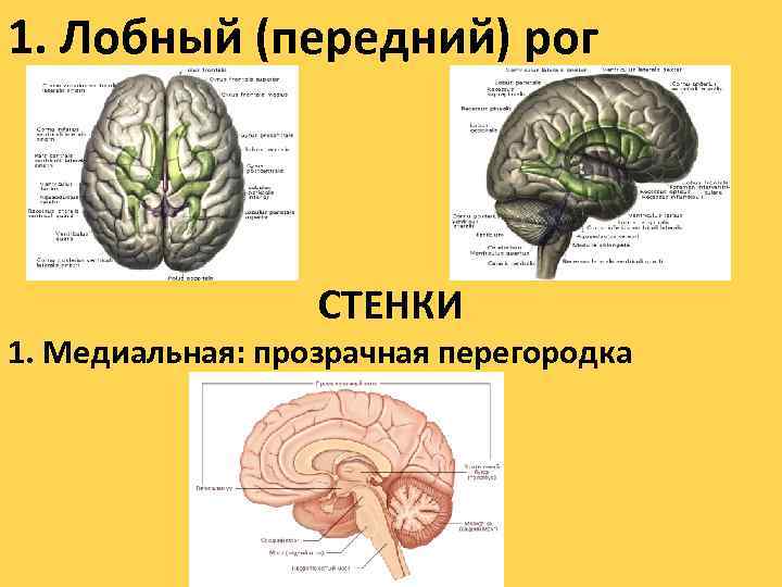 1. Лобный (передний) рог СТЕНКИ 1. Медиальная: прозрачная перегородка 