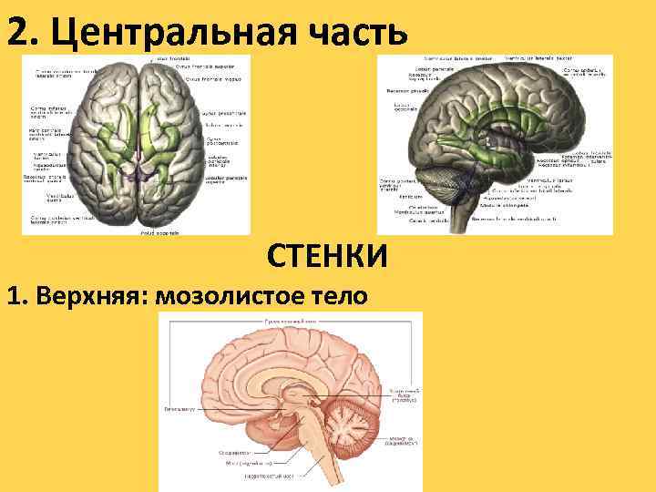 2. Центральная часть СТЕНКИ 1. Верхняя: мозолистое тело 