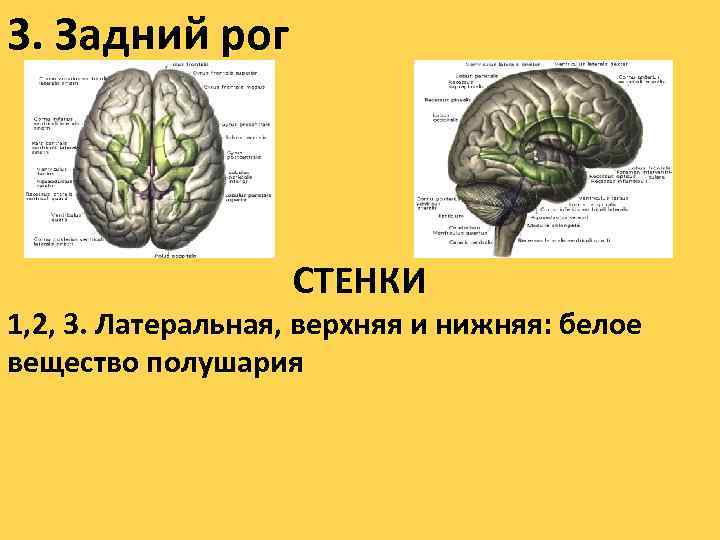 3. Задний рог СТЕНКИ 1, 2, 3. Латеральная, верхняя и нижняя: белое вещество полушария