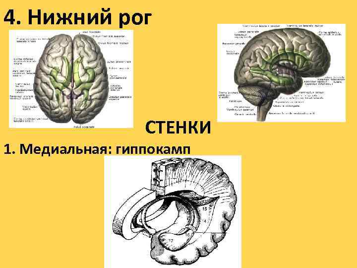 4. Нижний рог СТЕНКИ 1. Медиальная: гиппокамп 