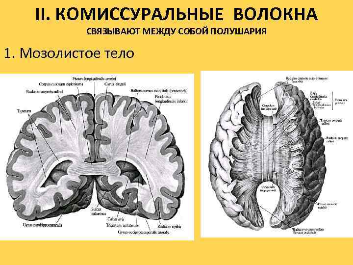 II. КОМИССУРАЛЬНЫЕ ВОЛОКНА СВЯЗЫВАЮТ МЕЖДУ СОБОЙ ПОЛУШАРИЯ 1. Мозолистое тело 