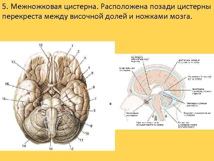 5. Межножковая цистерна. Расположена позади цистерны перекреста между височной долей и ножками мозга. 