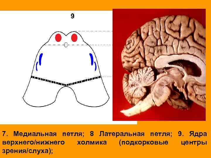 9 7. Медиальная петля; 8 Латеральная петля; 9. Ядра верхнего/нижнего холмика (подкорковые центры зрения/слуха);