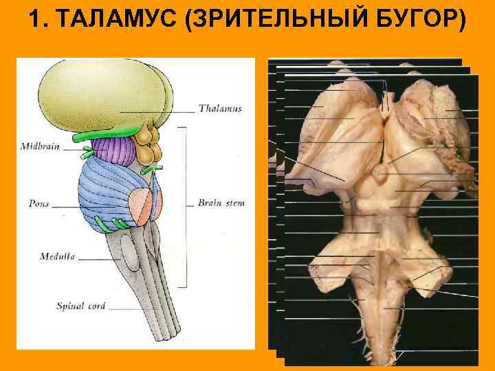 1. ТАЛАМУС (ЗРИТЕЛЬНЫЙ БУГОР) 