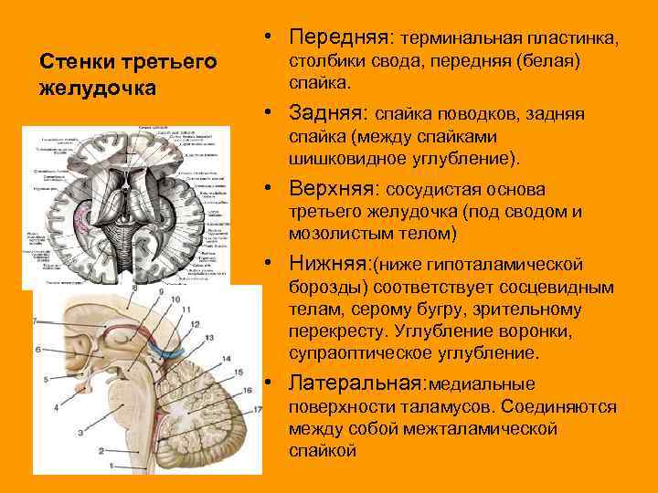 Стенки третьего желудочка • Передняя: терминальная пластинка, столбики свода, передняя (белая) спайка. • Задняя: