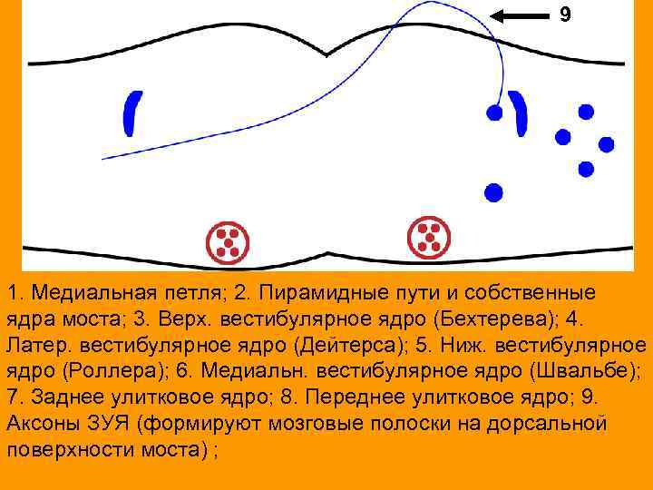 9 1. Медиальная петля; 2. Пирамидные пути и собственные ядра моста; 3. Верх. вестибулярное