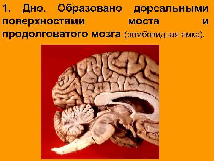 1. Дно. Образовано дорсальными поверхностями моста и продолговатого мозга (ромбовидная ямка). 