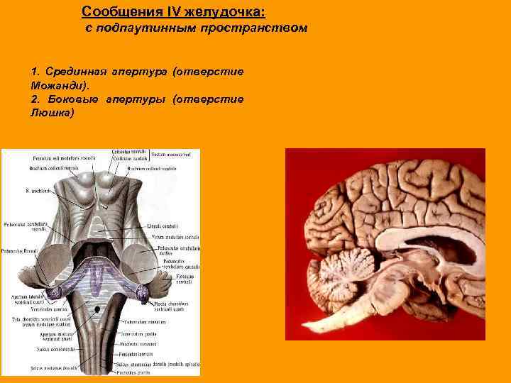 Сообщения IV желудочка: с подпаутинным пространством 1. Срединная апертура (отверстие Можанди). 2. Боковые апертуры