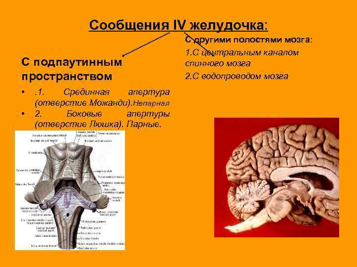 Сообщения IV желудочка: С подпаутинным пространством • • . 1. Срединная апертура (отверстие Можанди).