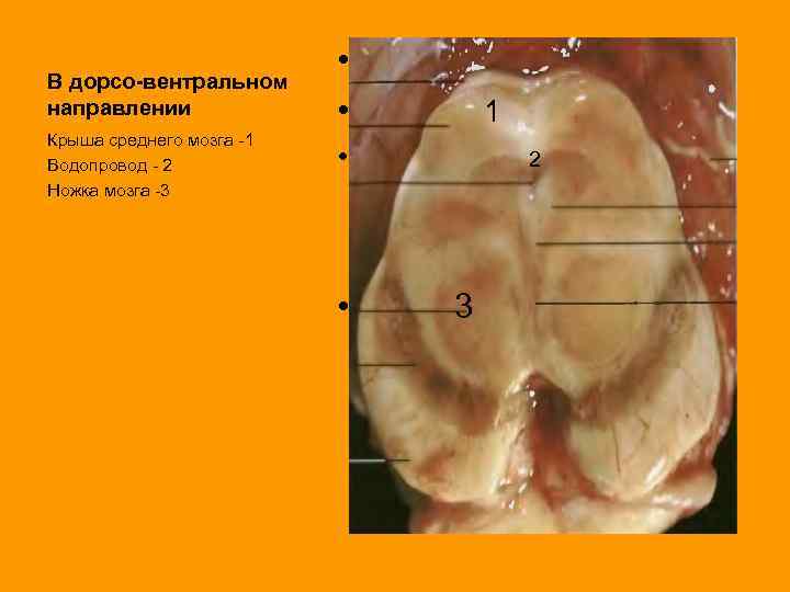 В дорсо-вентральном направлении Крыша среднего мозга -1 Водопровод - 2 Ножка мозга -3 •