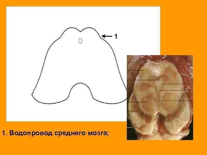 1 1. Водопровод среднего мозга; 